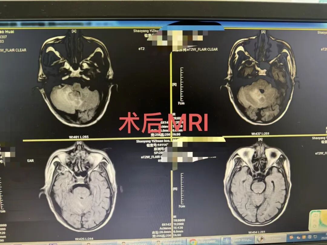 undefined 图片