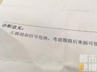 陕西孕妇产下罕见胎中胎 男婴腹中
